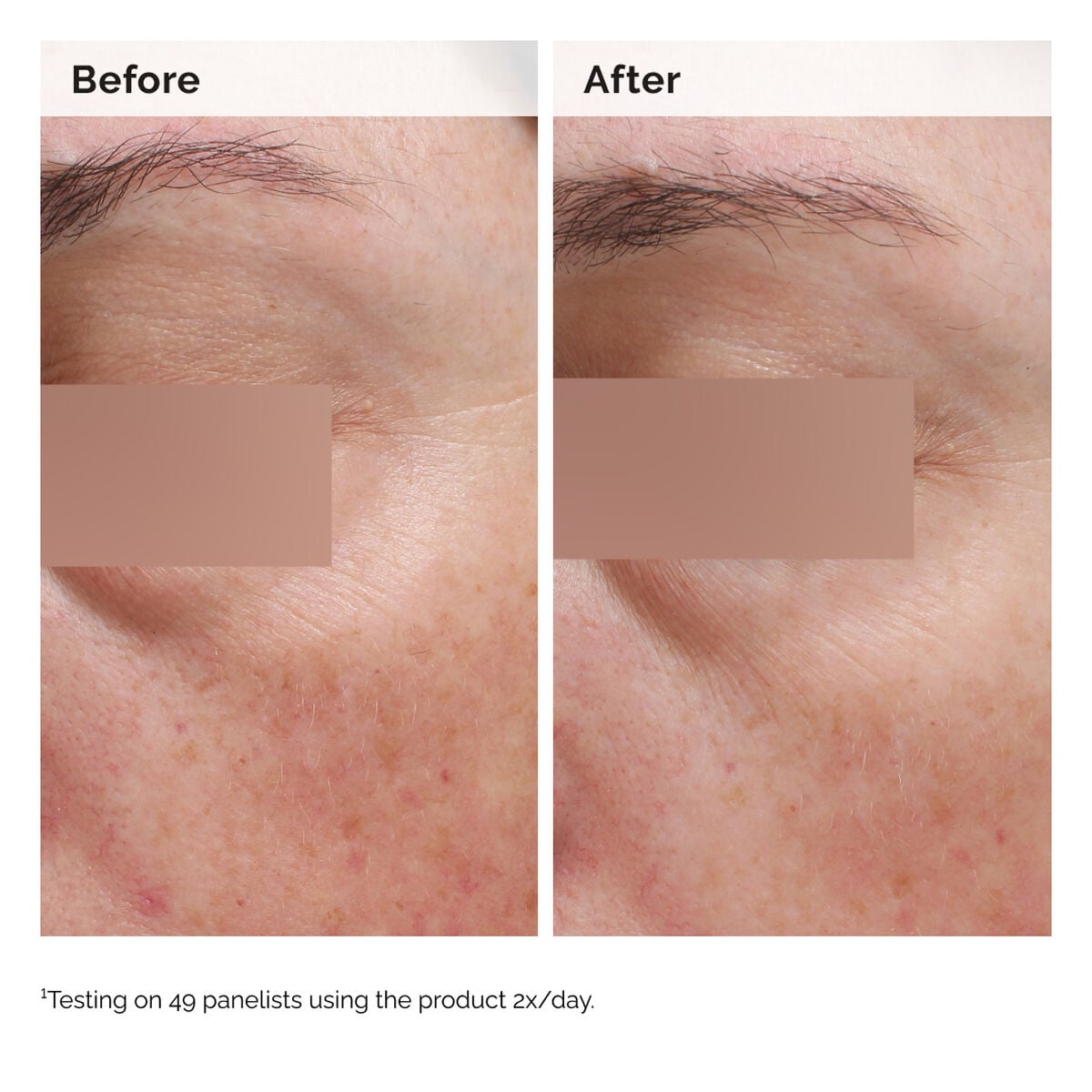 niacinamide-5-face-and-body-emulsion-n7 2024-08-23-ORD-Nia-5pct-Face-Body-B-A-Elasticity-Global-02-1x1.jpg