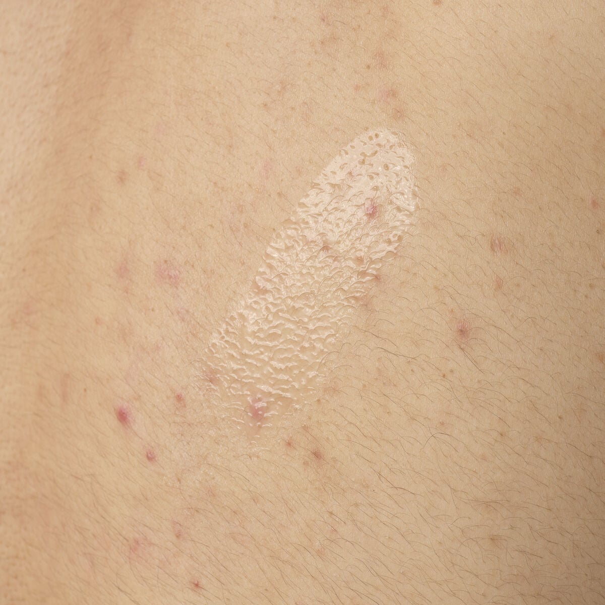 salicylic-acid-0-5-body-serum-n2 ORD-salicylic-acid-05-body-240ml-application.jpg