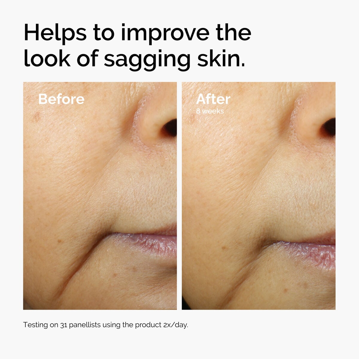 caffeine-3-escin-1-face-serum-f9 ord-caffeine-3pct-escin-1pct-face-serum-before-after-sagging.jpg