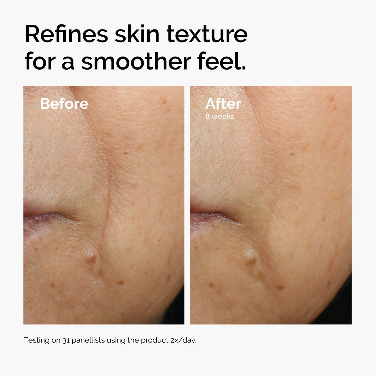 caffeine-3-escin-1-face-serum-f9 ord-caffeine-3pct-escin-1pct-face-serum-before-after-texture.jpg