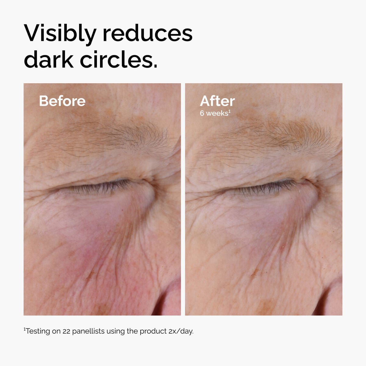 caffeine-solution-5-egcg-eye-serum-d3 ord-caffeine-solution-egcg-dark-circles-before-after.jpg
