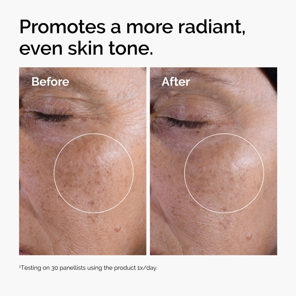 glycolic-acid-7-exfoliating-toner-h5 ord-glycolic-before-after-radiance.jpg