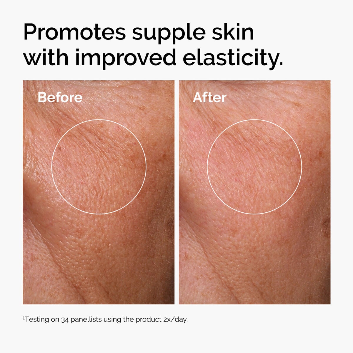 hyaluronic-acid-2-b5-with-ceramides-b7 ord-hyaluronic-acid-2pct-b5-hydrating-serum-before-after-elasticity.jpg