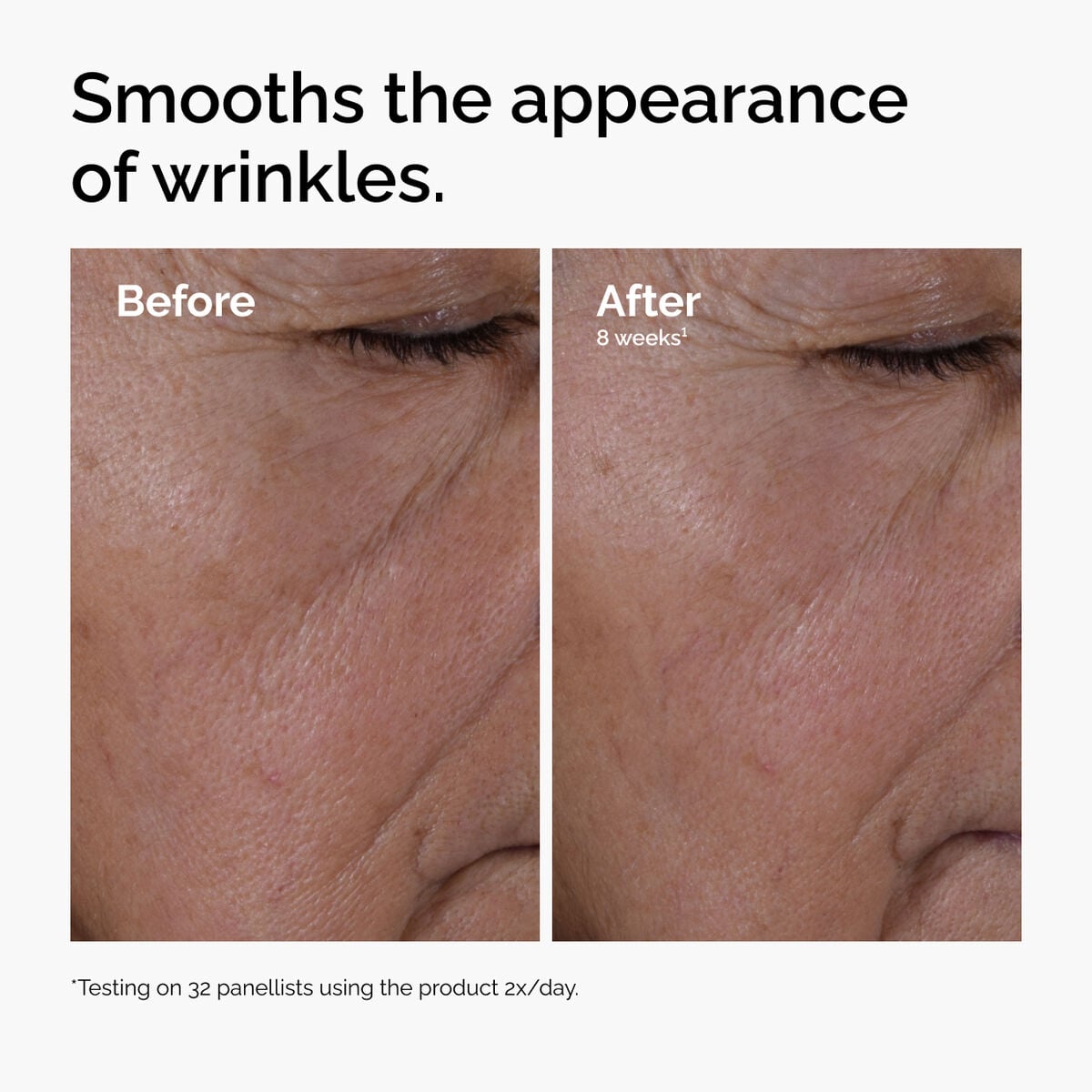 multi-peptide-ha-serum-a6 ord-multi-peptide-ha-serum-wrinkles-before-after.jpg